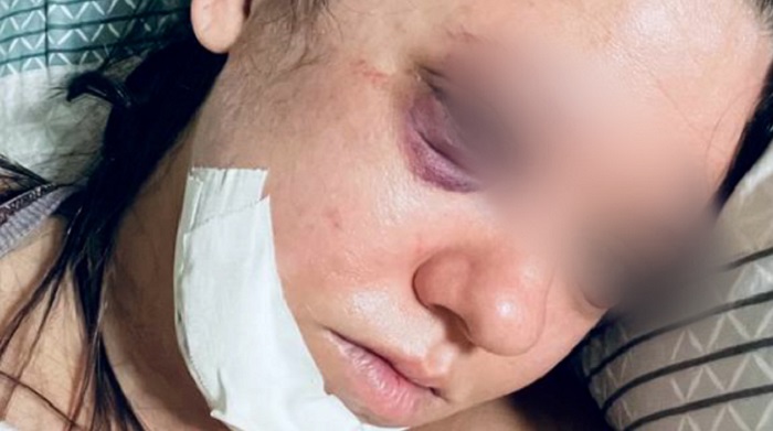 Justiça manda soltar homem que espancou brutalmente namorada no AM22