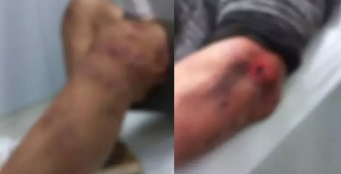 Homem fica gravemente ferido após ser agredido por 8 pessoas com golpes de enxada e madeira