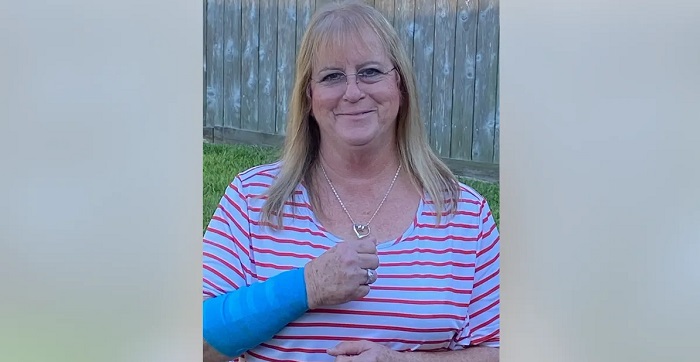 Braço de mulher é atacado ferozmente por falcão após cobra cair do céu; entenda