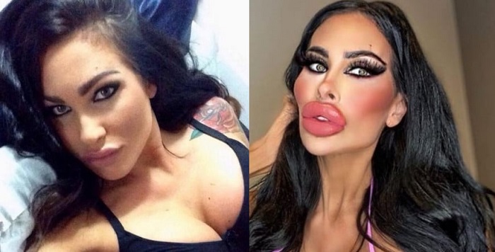 modelo gasta R$ 1,2 milhão em cirurgias e diz que ativou o ‘modo boneca’ YES