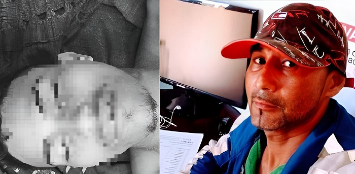 Suspeito de matar servidor da Seminf, “Marcelo Satanás” morre após trocar tiros com a polícia