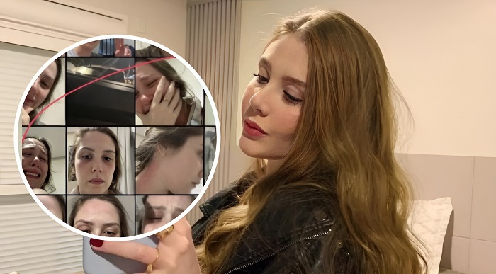 Jovem que teve o celular roubado não foi agredida pelo namorado, diz a polícia