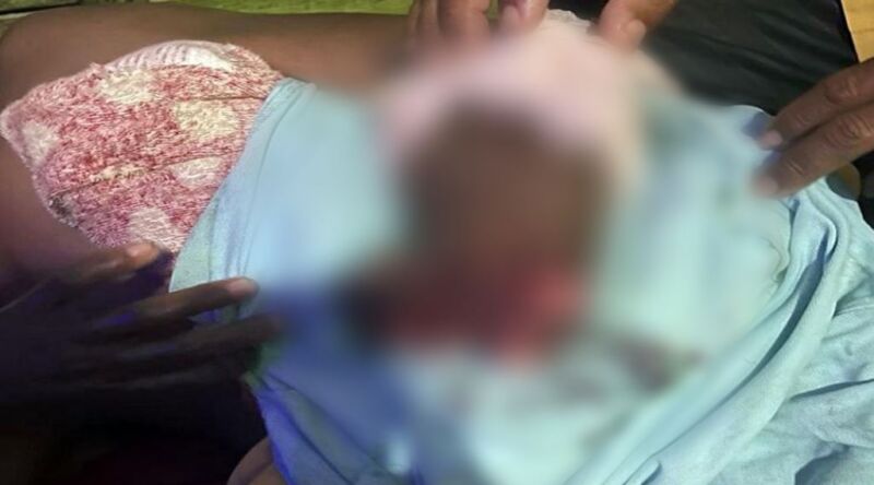 CENAS FORTES! Pescador é atacado por jacaré e tem braço dilacerado no Amazonas