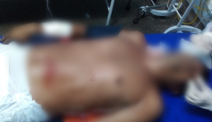 Irmão de Zé Roberto é baleado com mais de cinco tiros em Manaus