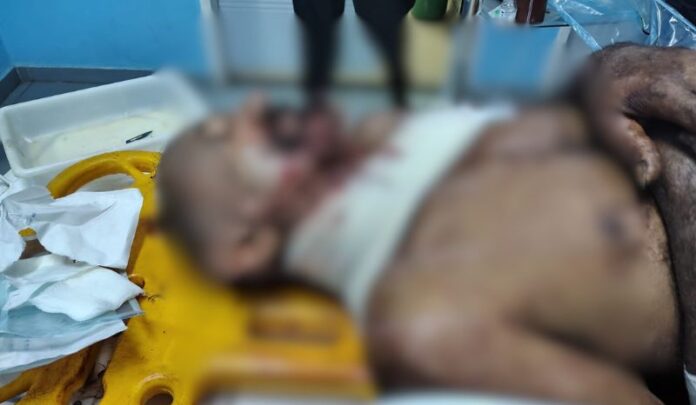 VÍDEO Idoso é ferido com terçadadas ao reagir a assalto em Manacapuru (AM)